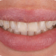 Visit Reputed Dentists Assisting with Laser Teeth Whitening and Cleaning Treatments