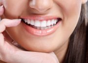 How Dental Bonding Can Enhance Discolored Teeth In New York?