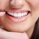 How Dental Bonding Can Enhance Discolored Teeth In New York?