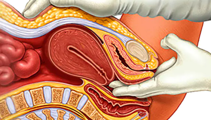 The Details You Should Know About Ovarian Cancer