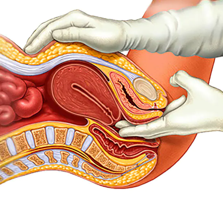 The Details You Should Know About Ovarian Cancer