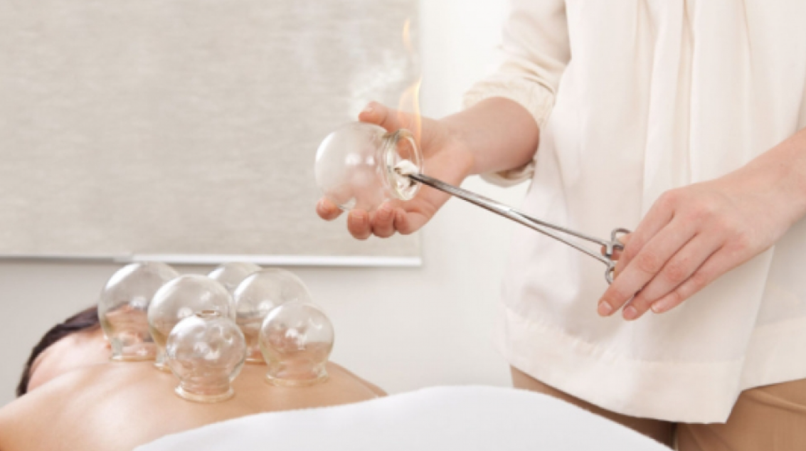 Vacuum Cupping and Traditional Chinese Medicine: What’s better for you?