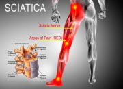 What Is the Best Massager for Sciatica Pain: Top Picks