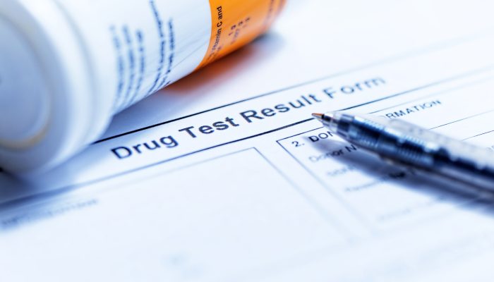 How Pre-Employment Drug Testing Contributes to a Healthier and More Productive Workforce