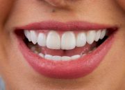 How Much Do Veneers Cost? A Guide to Smile Transformation Expenses