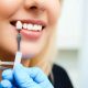 Transforming Oral Health With Dental Implants