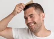 A Complete Hair Transplant Timeline for Regaining Confidence