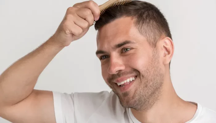 A Complete Hair Transplant Timeline for Regaining Confidence